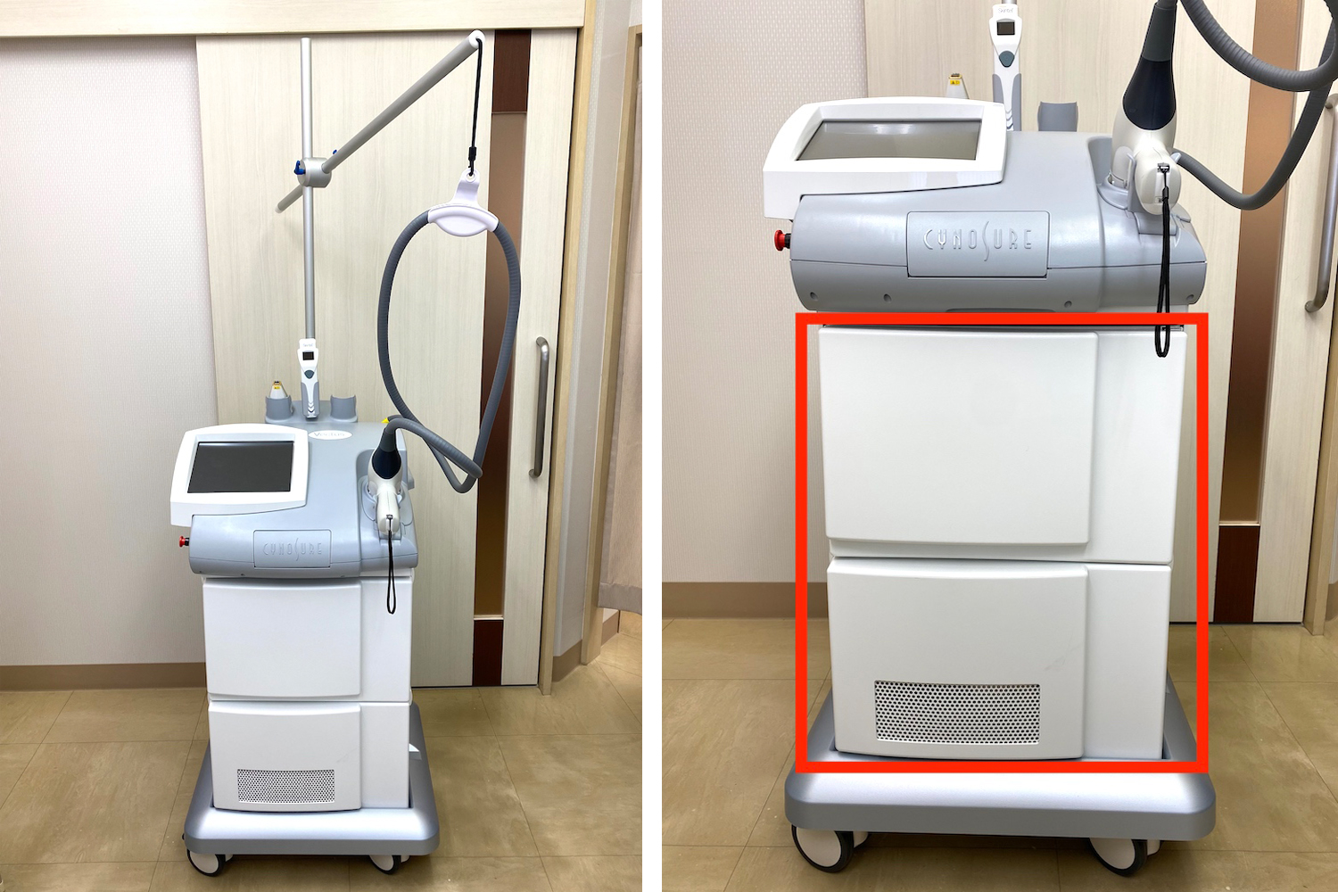 新型レーザー脱毛機「Vectus」を導入しました！ | 松島皮膚科医院