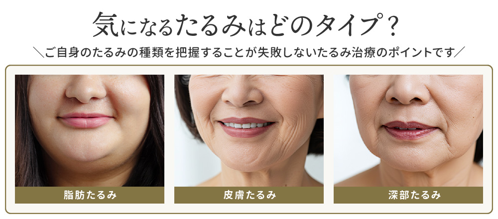 高周波たるみ治療 戦国時代！】ボルニューマ・オリジオ・ザーフなど