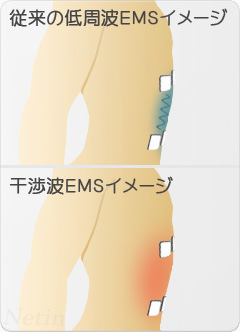 ツインビート3ターボの販売 「ツインビート3ターボ、消耗品販売店」