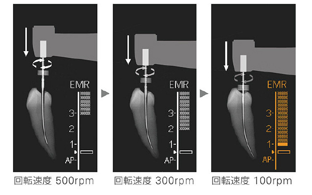 モリタ トライオートzx2＋のご紹介｜ササキ株式会社