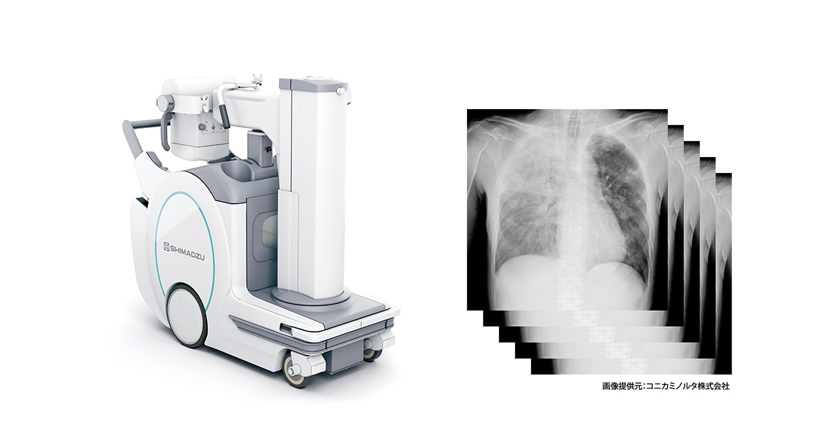 SHIMADZU] 回診用X線撮影装置に連続撮影機能を搭載 移動困難な患者に