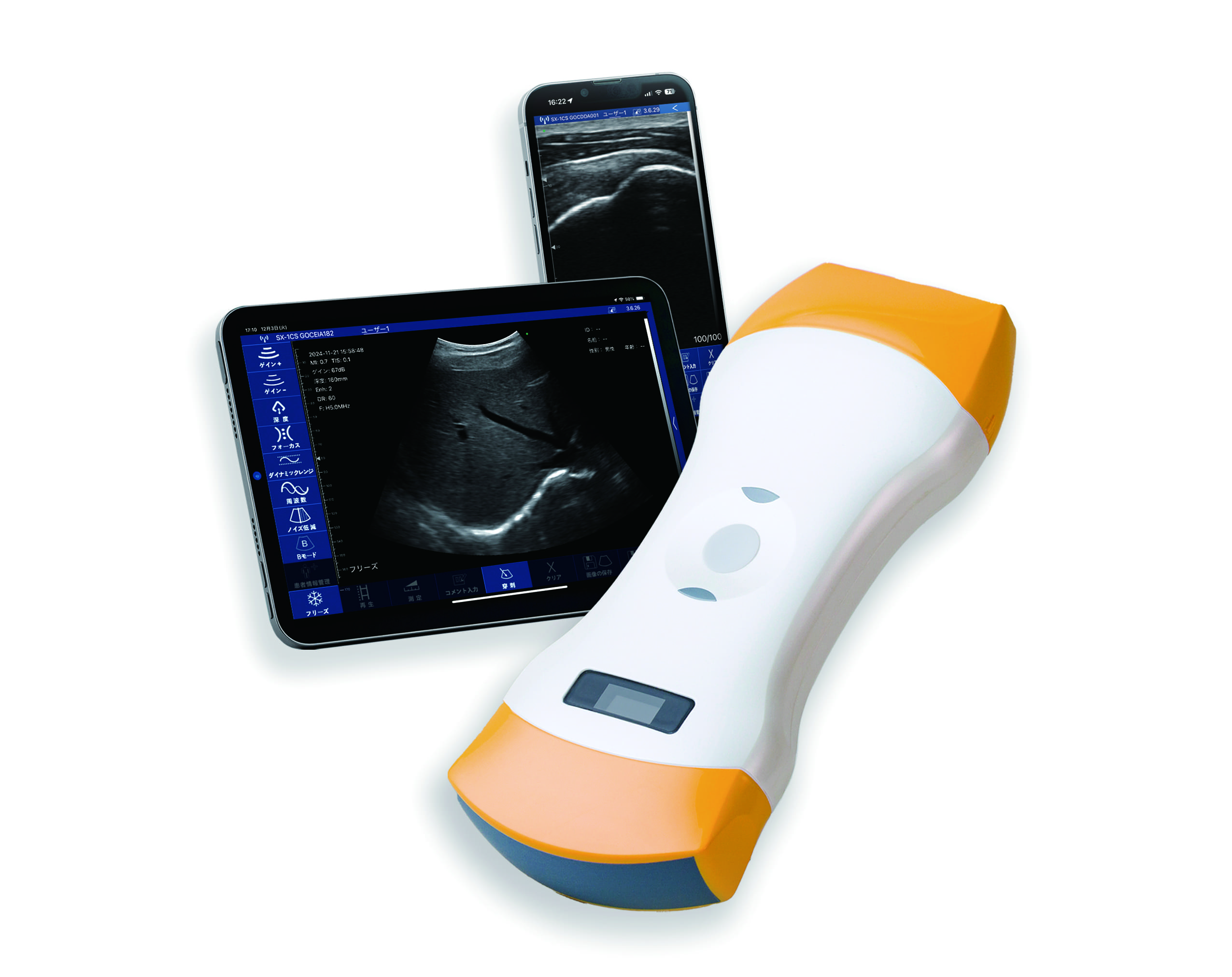 超音波画像診断装置「ポケットエコーmiruco」（販売終了）製品情報