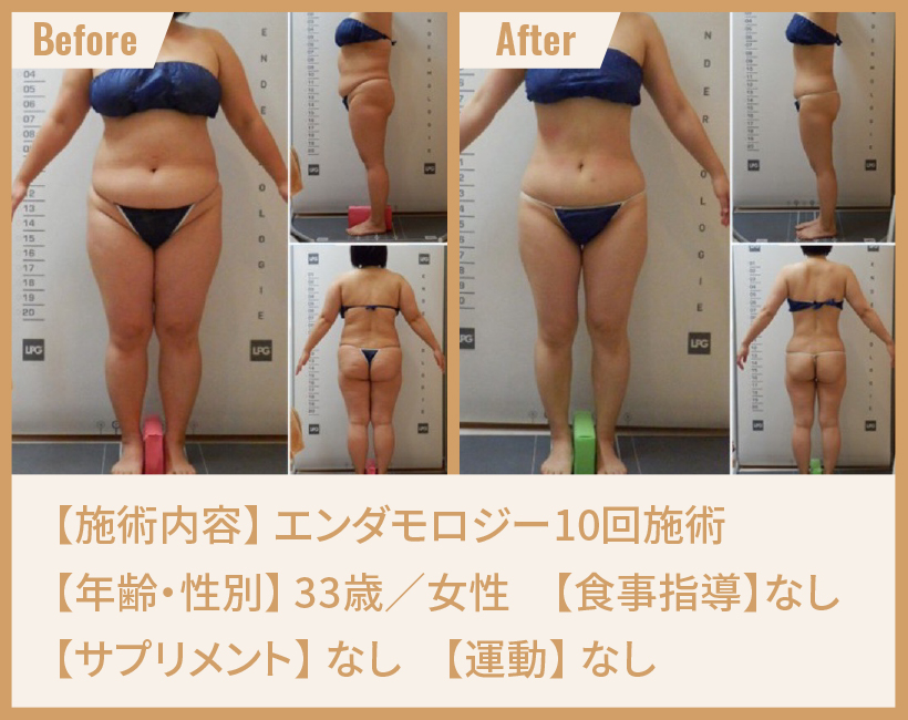 エンダモロジー – SUPER SIX