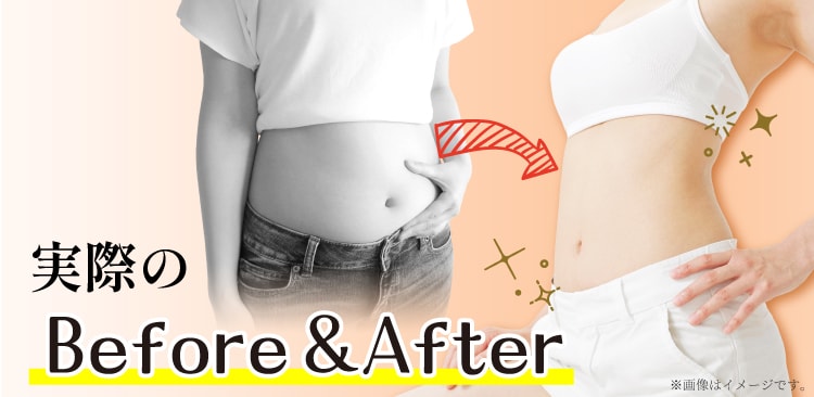 汗だくセルライトproコースとエステ体験の紹介｜痩身・脚やせならラ