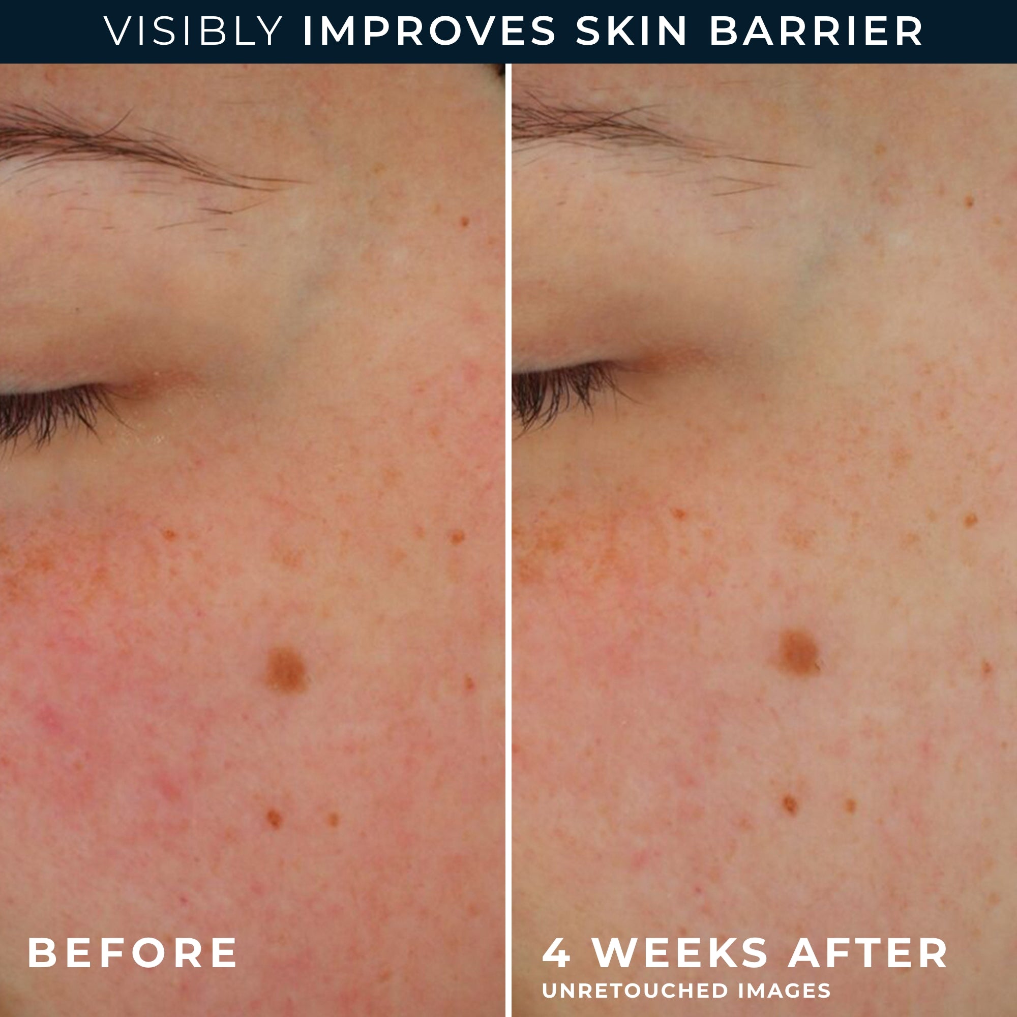 Barrier Renew® AM Moisturizer SPF 30 - RoC® Skincare