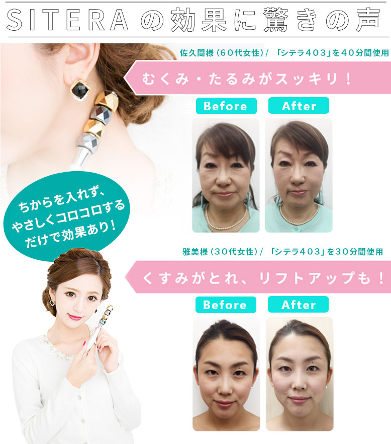 楽天市場】正規品 美ボディローラー(商品のみ) | SITERA シテラ403