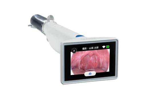 AI搭載インフルエンザ検査機器「nodoca」｜品川・天王洲アイルの品川