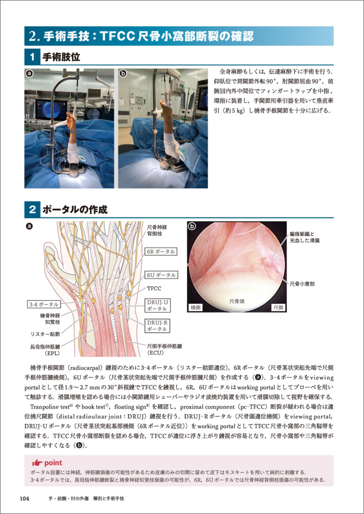 手・前腕・肘の外傷 解剖と手術手技 - 羊土社