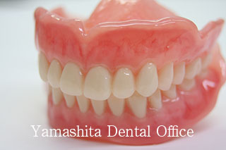 治療用義歯 | 大阪精密入れ歯治療室