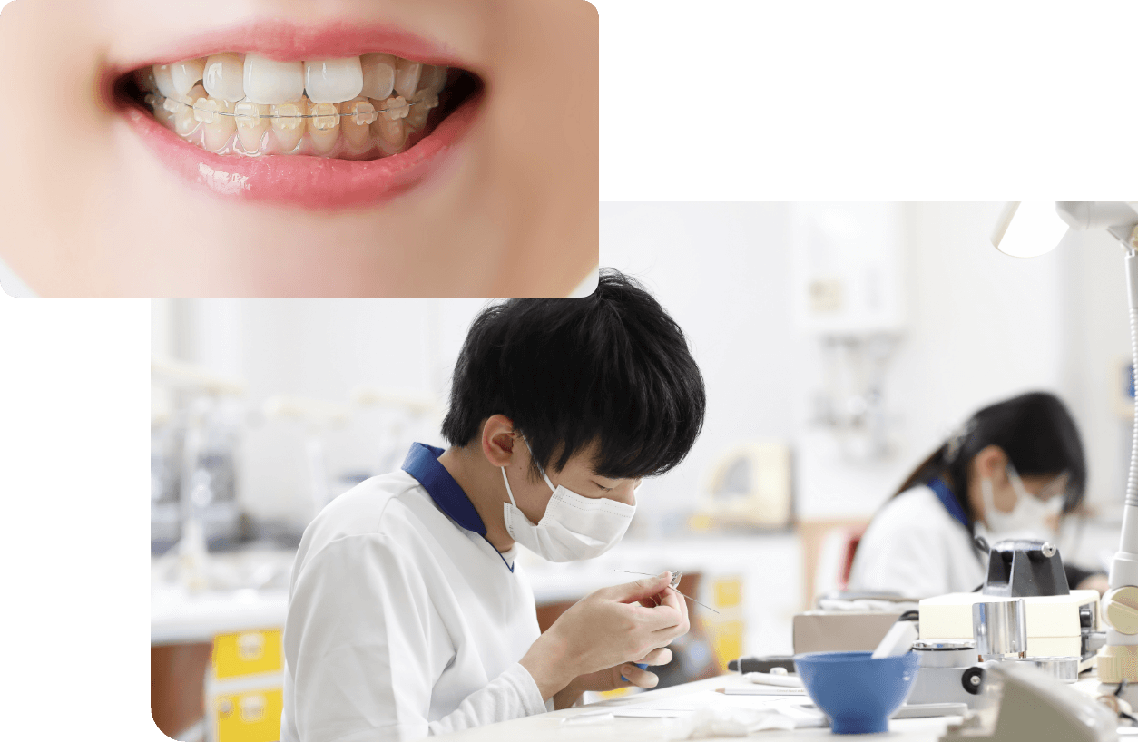 歯科技工士とは