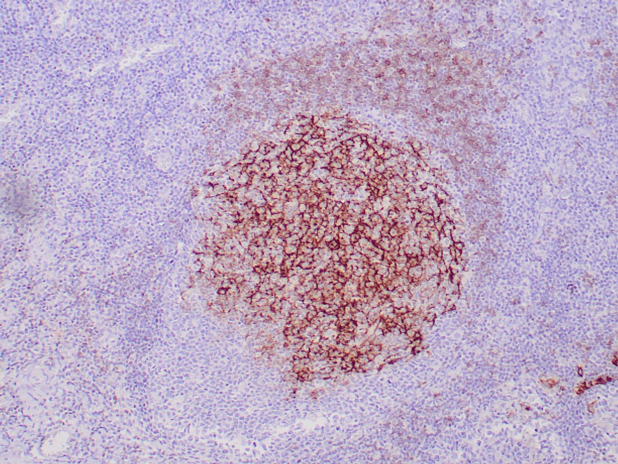 CD23 Antibody - Recombinant IVD Antibody for IHC - Zeta Corporation