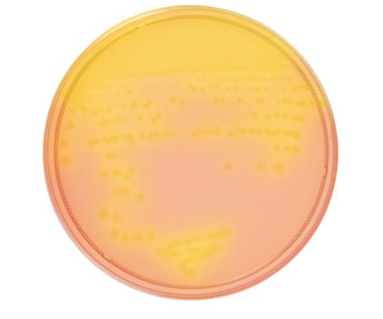 63-6527-31 BD BBL（TM） CCFA培地 10枚 251983 【AXEL】 アズワン