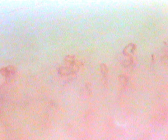 7-7904-01 毛細血管スコープ（血管美人） SC-10 【AXEL】 アズワン