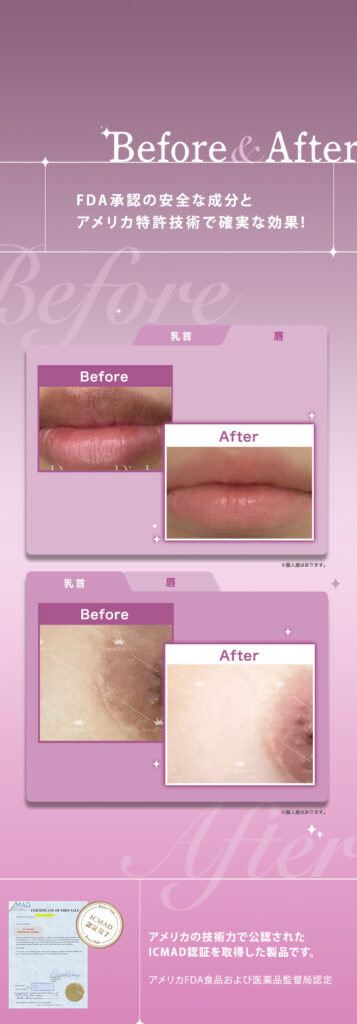 浜松市でローマピンク（Roma Pink）をお考えの方へ｜浜松市の女医