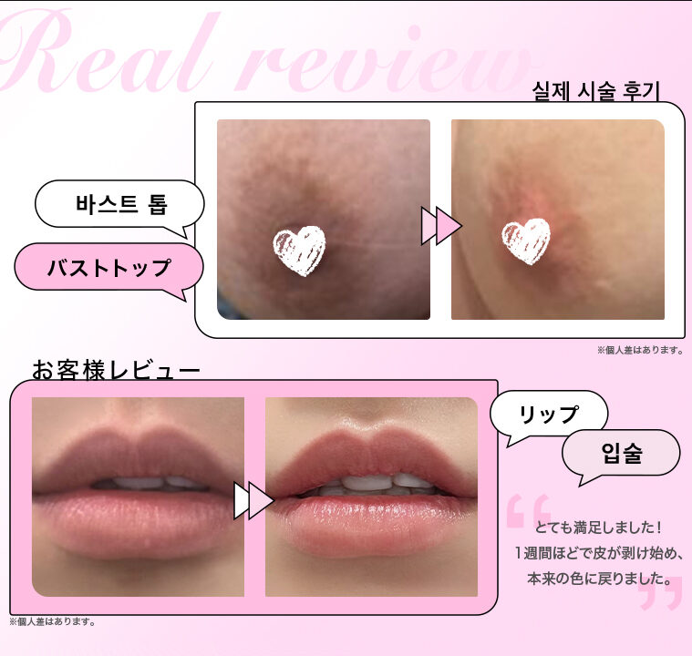 浜松市でローマピンク（Roma Pink）をお考えの方へ｜浜松市の女医