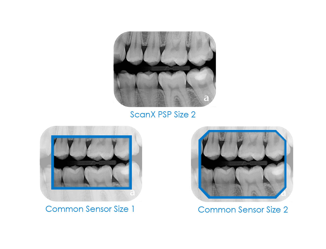 スキャンX デュオ | Air Techniques |
