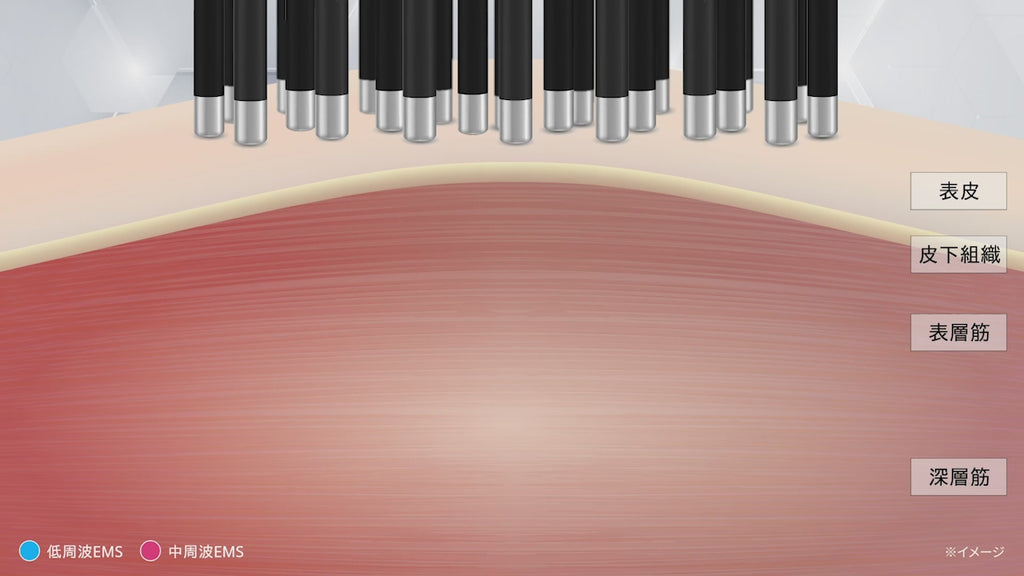 ヤーマン ヴェーダハイパーリフトブラシ ヤーマン美顔器 電気