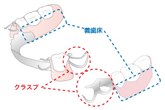 義歯・入れ歯 | アップル歯科尼崎駅前