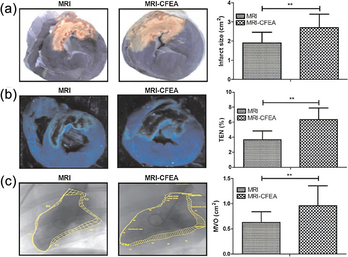 Metal-based nanoparticles for cardiovascular disease diagnosis and