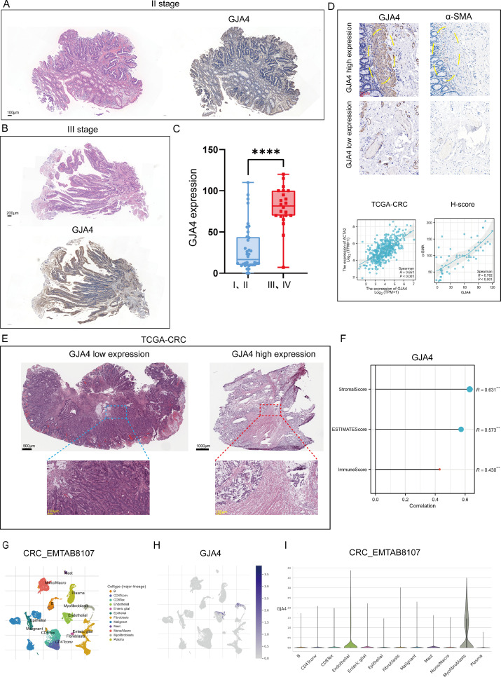 GJA4 expressed on cancer associated fibroblasts (CAFs)—A 'promoter