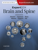 Expertddx: Brain and Spine | ScienceDirect