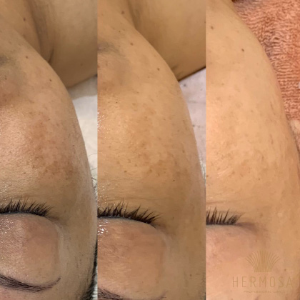 美骨艶肌サロン TORIE（トリエ） | HERMOSA