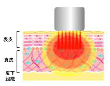 BE-BE | 製品情報 | BECO JAPAN