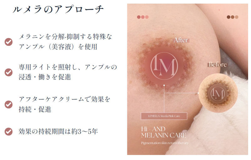 LEMELLA ルメラ | Beauty salon Coco a Doll - ビューティーサロン