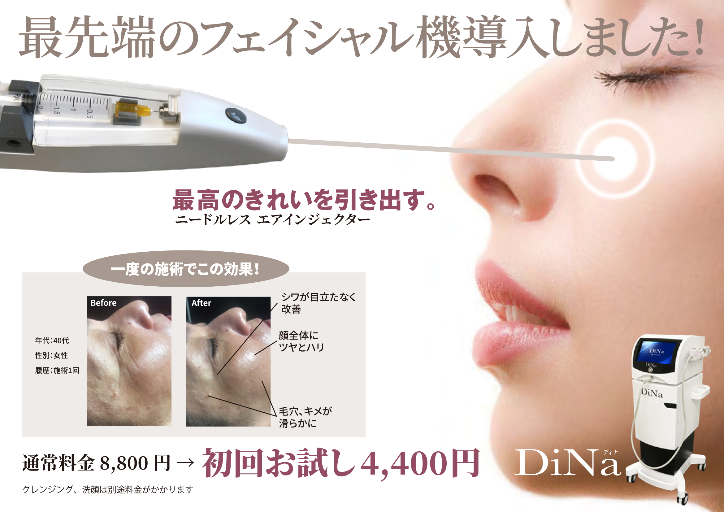 無針水光注入DiNa導入しました！初回お試し4,400円！ – 長浜・彦根の