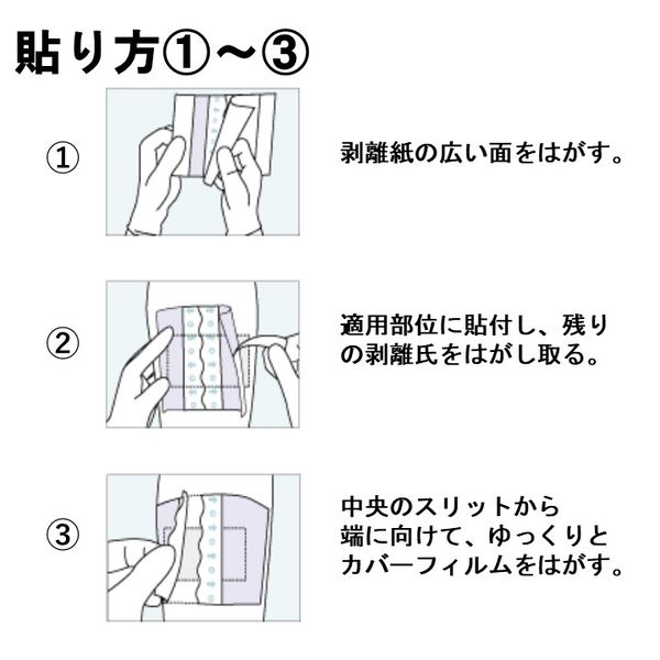ニトムズ 優肌パーミロール Lite L34R10 5巻 フィルムドレッシング