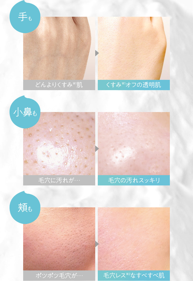 おまとめ6個セット】どろあわわ（洗顔料） 泡立てネット付 ｜チョコザップ