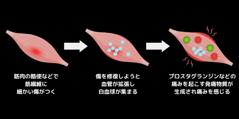 筋肉をダメージから守る！CK値を抑制！ – カツサプ公式サイト