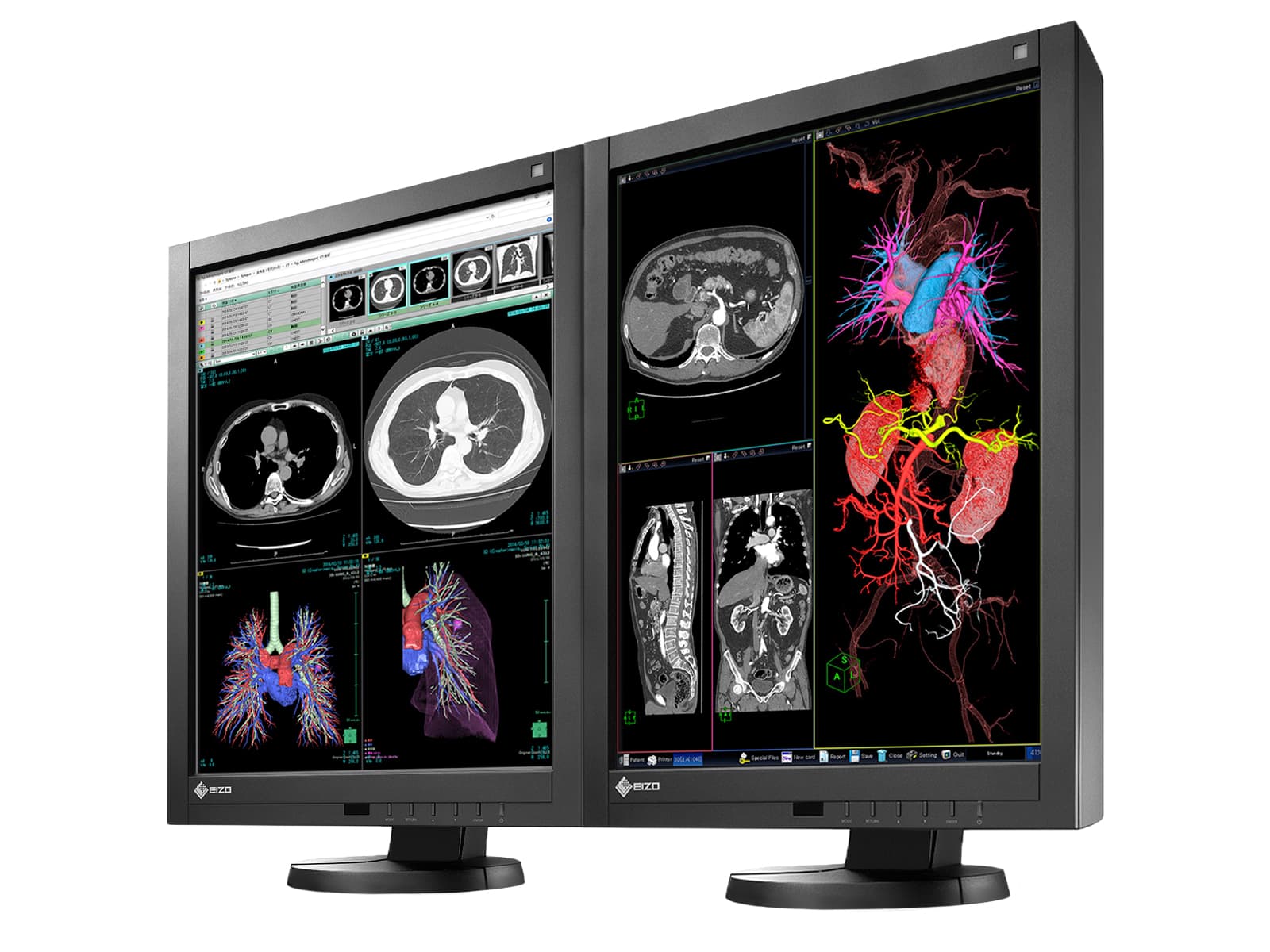 Eizo Radiforce RX340 3MP 21