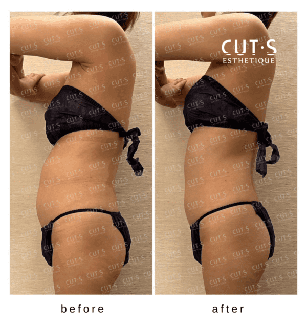 NEW 痩身マシン】30分で約3万回の筋肉収縮！マグシェイプ！ | 福山の