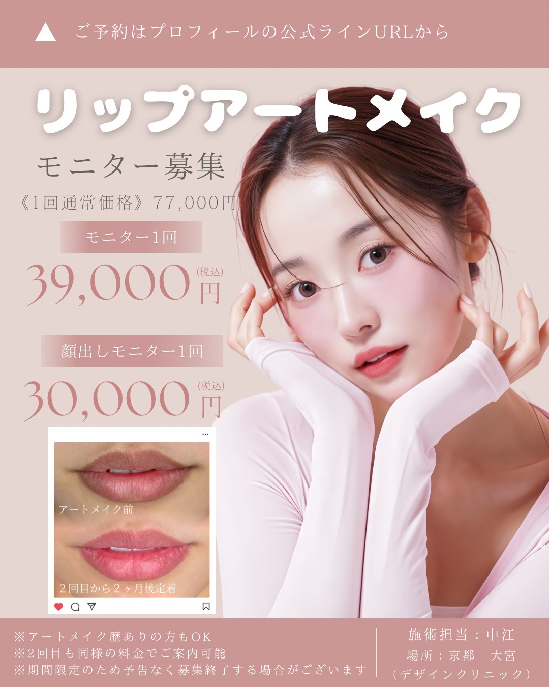 京都・滋賀で医療アートメイクをするなら「デザインクリニック」へ