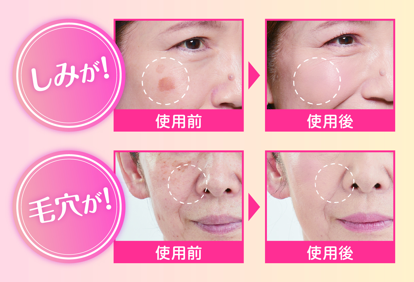 キミエオールインワンクッションファンデーション｜富山常備薬【公式通販】