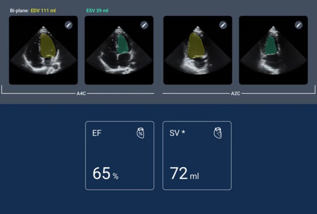 Kosmos AI-powered POCUS in Japan