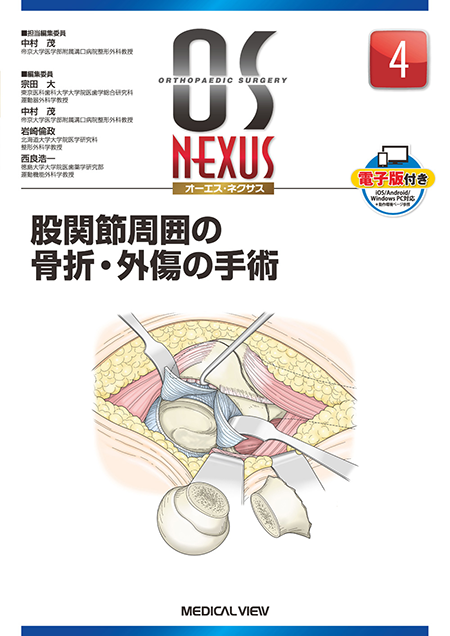 m3電子書籍 | OS NEXUS3 手・手関節の骨折・外傷の手術