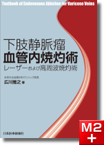 m3電子書籍 | ステントグラフト内挿術マニュアル 腹部編