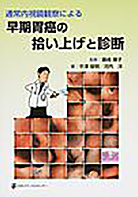 m3電子書籍 | こんなときどうする!? 食道癌・咽頭癌 内視鏡の達人たち