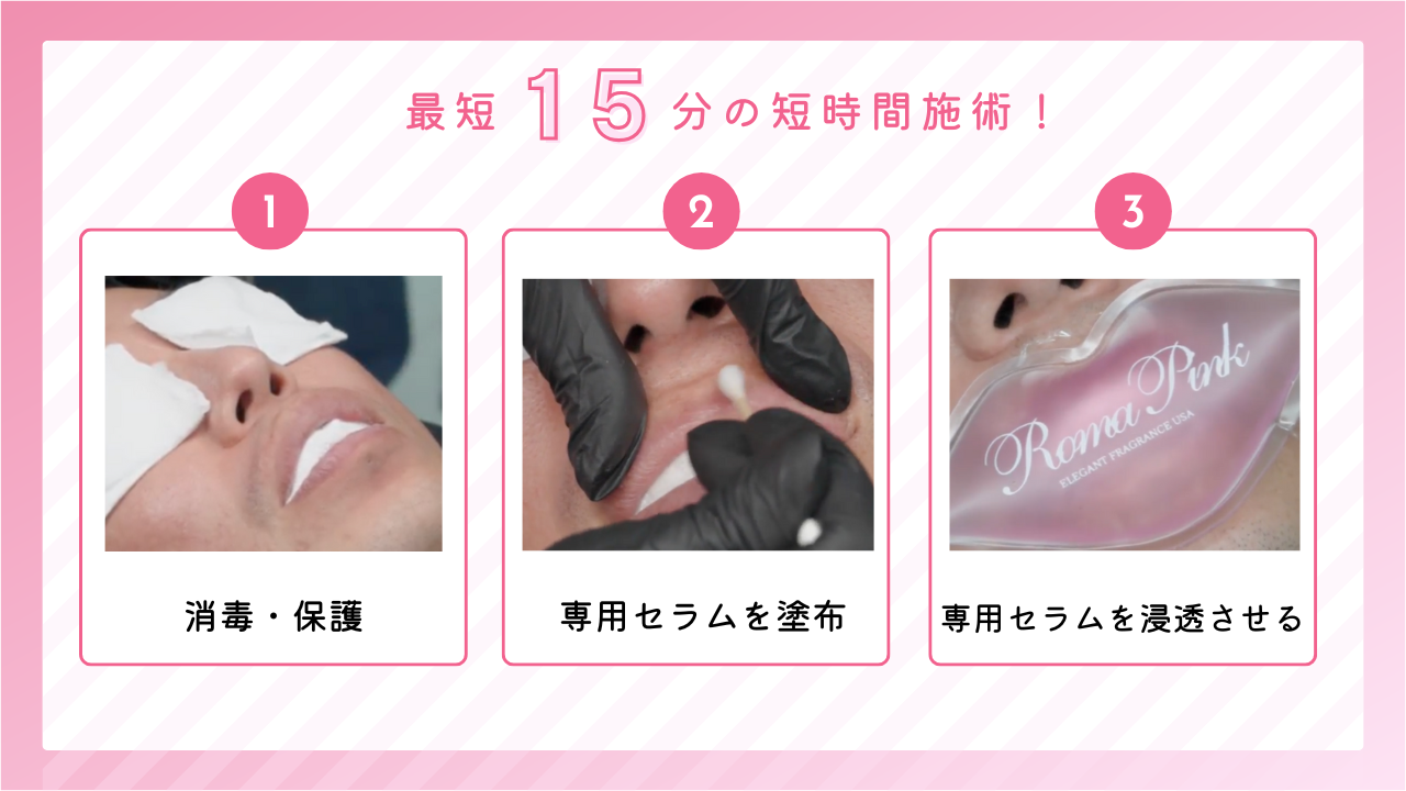 ローマピンクが新潟で安いおすすめサロン3選｜モニター価格・割引