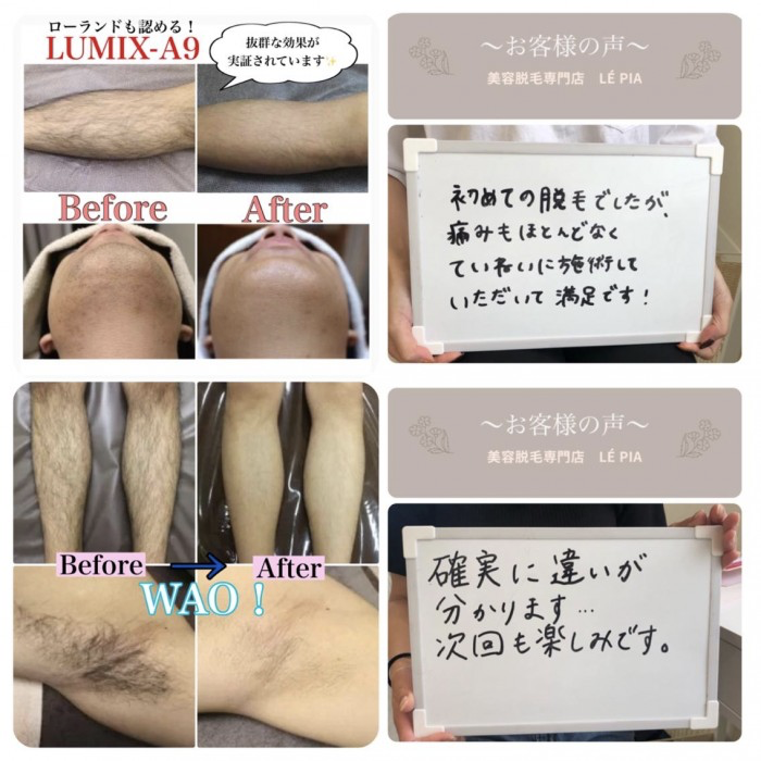業務用脱毛機ルミクスA9の特徴、脱毛効果、マシン価格についてご紹介