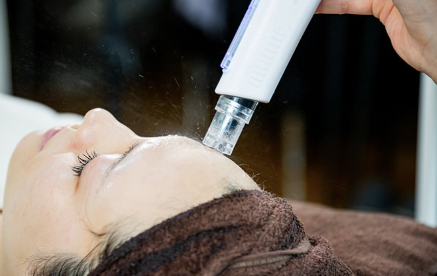 業務用美顔器エアバリとは？｜機械の値段や特徴・効果などご紹介