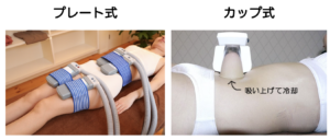 おすすめの【業務用】脂肪冷却痩身マシンTOP6｜マシン選びのポイント