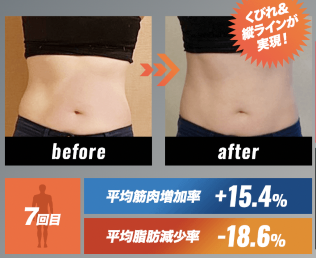 電磁パルス痩身機ボディカルプトの特徴や効果、価格についてご紹介