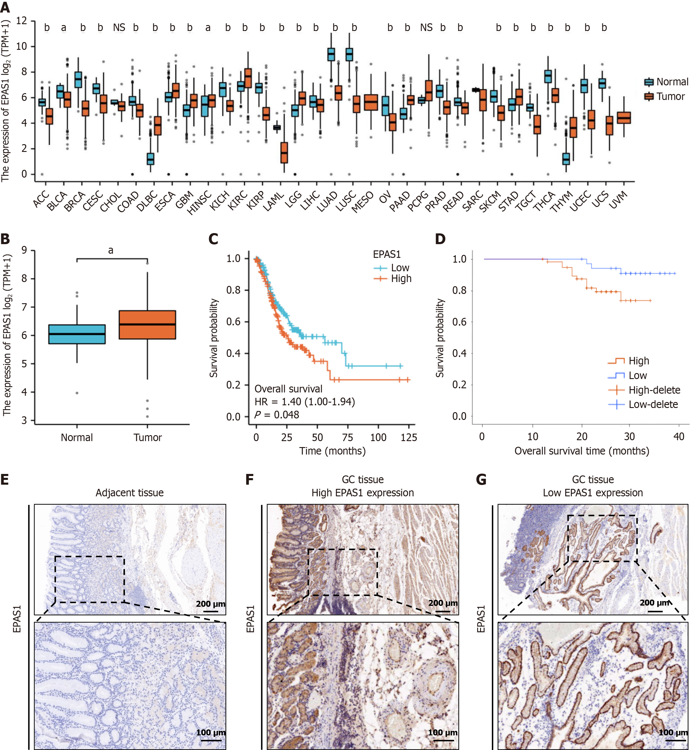 Endothelial Per-Arnt-Sim domain-containing protein 1 expression is