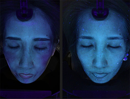 アクサフェイス | 業務用美容・エステ機器の卸・仕入通販は【ミヤタッチ】