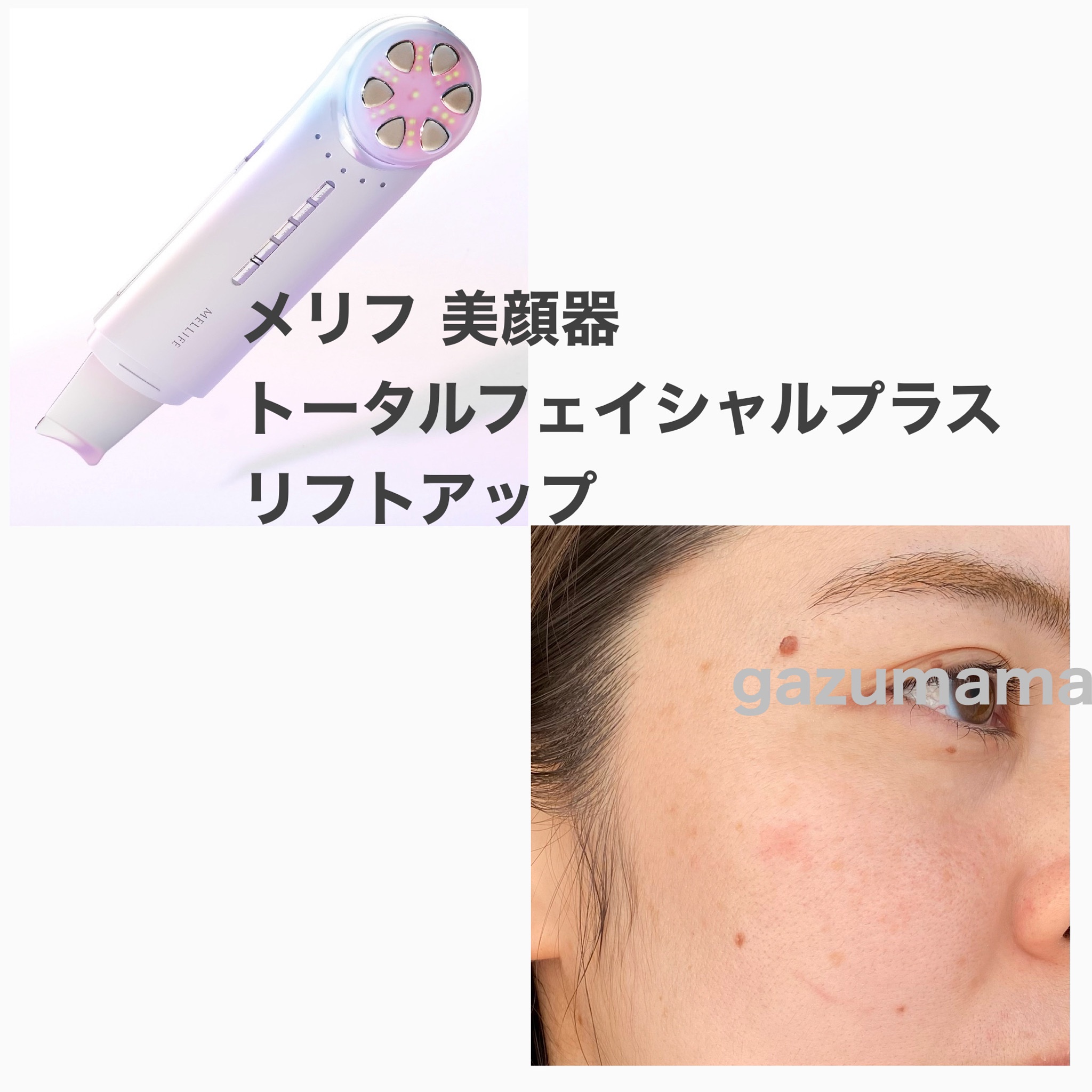 MELLIFE(メリフ) / total facial plusの公式商品情報｜美容・化粧品