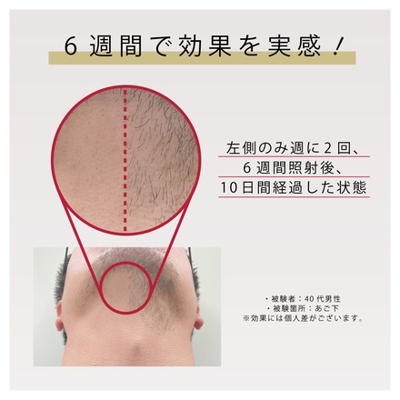 Be・Escort(ビー・エスコート) / .0(ドットゼロ) 家庭用光美容器