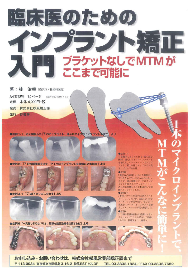 書籍詳細「インプラント矯正入門」 | フォルディネット